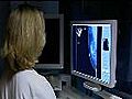 UCSF study may impact breast cancer treatment