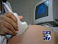 VIDEO: Pregnant women and allergy concerns