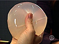 FDA: Breast implants don’t last forever