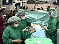 Lap Band Surgery