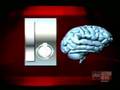 [Video] IBS(Irritable Bowel Syndrome)may start in the brain