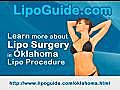 Lipo Oklahoma