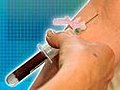 Blood test to spot cancer gets big boost