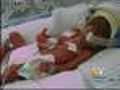 Premature Baby Goes Home After 10 Weeks