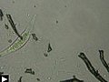le litonotus,  protozoaire cilié prédateur