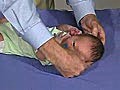 Head Circumference Clinical Pediatrics