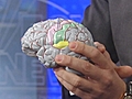 Dr. Samadi Talks About Concussions
