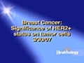 Treating HER2+ Breast Cancer