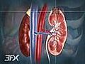 Nephropathy