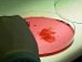 Stem Cells Could Repair Heart Tissue