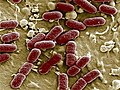 Deadly E.coli is new strain of bacteria