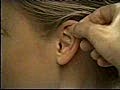 Ear Examination