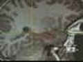 New Guidelines Proposed To Diagnose Alzheimer’s
