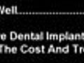 Dentist Harrisonburg VA Are Dental Implants Worth The Cost?