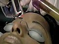 [Video] New lasers for ethnic skin