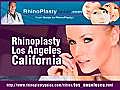 Rhinoplasty Los Angeles