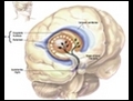 Parkinson tedavisinde beyin pili yöntemi nasil uygulanir?