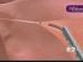 Seen At 11: Permanently Prevent Pregnancy