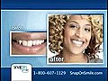 Snap-On Smile Removable Veneers - Get a Hollywood Smile!