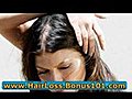 regrow hair naturally women - regrow hair faster naturally - regrow hair lifestyle