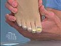 What Feet Say About Your Health