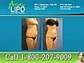 Tampa Lipo and Body Contouring