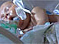 Heartbreaking Tale Of Premature Baby