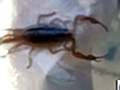 Man stung by scorpion at 30,000 ft.