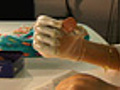 Brit Scientists Develop First Bionic Fingers