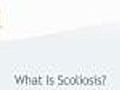 What Scoliosis is