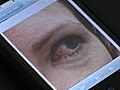 EyeSnapi lets doctors see patient’s eyes through app