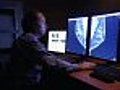 Digital Mammography is Safer for Women