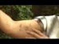 Man Claims Hospital Guards Beat Him