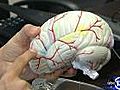 Medical advances help brain injury patients survive
