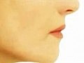 Cost Effective Chin Reshaping Surgery