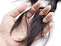 Menopozda saç dökülmesinin nedenleri nelerdir?