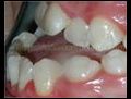 Ortodontik tedaviler pahali midir?