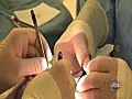 Gesicht Transplantationschirurgie