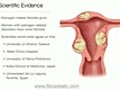 Causes Of Uterine Fibroids