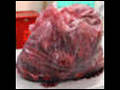 Anonymous Philanthropist Donates 200 Human Kidneys To Hospital