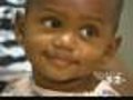 Baby Survives After Metal Rod Lodged In Brain