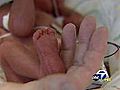 Nurse takes care of preemies for 41 years