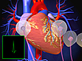 How Does the Heart’s Conduction System Work?