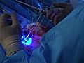 Surgeons use florescent light to target brain cancer