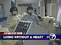 VIDEO: Girl survives 118 days without heart