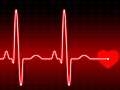Is My Heart Rate Normal?