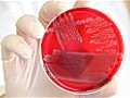 E.coli outbreak &#039;could be the biggest ever&#039;