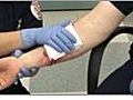 How to Treat a Bleeding Arm Wound