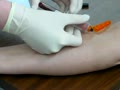 Drawing Blood Sample Venipuncture