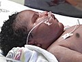 Baby’s Size Breaks Hospital&#039;s Record